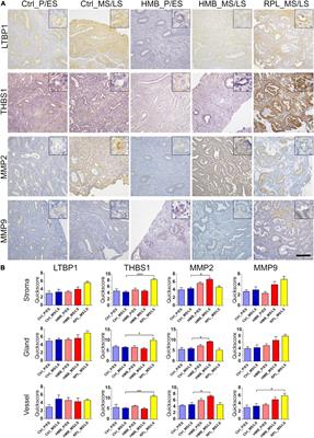 Transforming Growth Factor (TGF) β and Endometrial Vascular Maturation